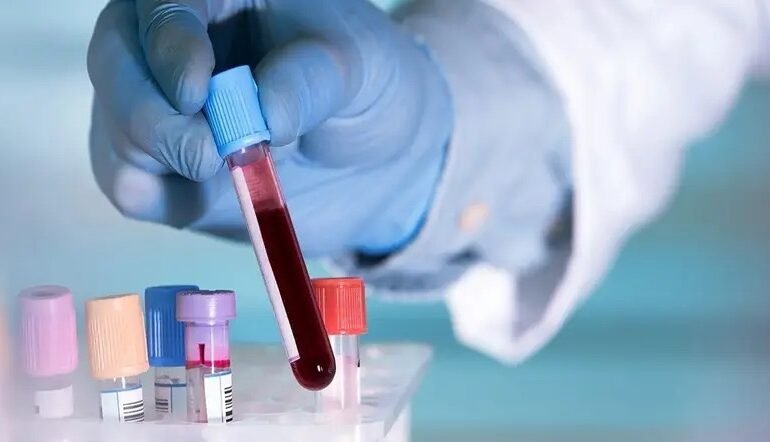 Desarrollan prueba rápida capaz de detectar cáncer de páncreas con una muestra de sangre