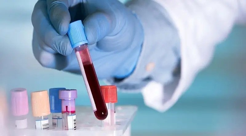 Desarrollan prueba rápida capaz de detectar cáncer de páncreas con una muestra de sangre