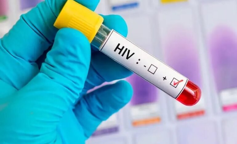 OPS anuncia tratamiento médico para prevenir el VIH