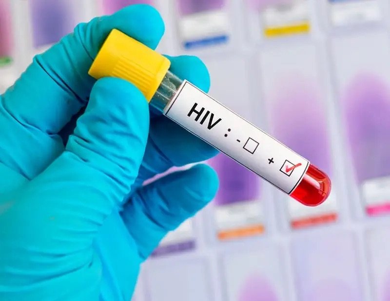 OPS anuncia tratamiento médico para prevenir el VIH
